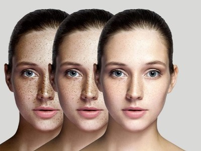 Kem chống nắng da nhạy cảm có thật sự quan trọng?